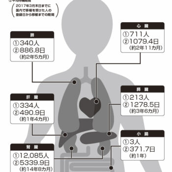 10月は「臓器移植普及推進月間」｜臓器提供○でも×でもまずは意思表示を