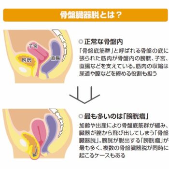 【泌尿器科にみる】ニーズに応える医療